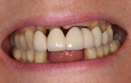Smile Gallery - Church Road Dental and Cosmetic
