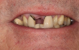 Smile Gallery - Church Road Dental and Cosmetic