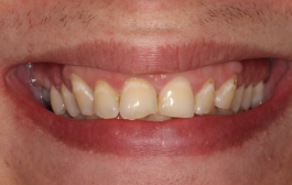 Smile Gallery - Church Road Dental and Cosmetic