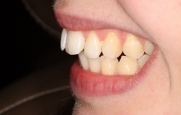 Smile Gallery - Church Road Dental and Cosmetic