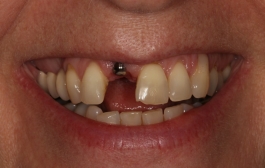Smile Gallery - Church Road Dental and Cosmetic