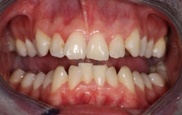 Smile Gallery - Church Road Dental and Cosmetic