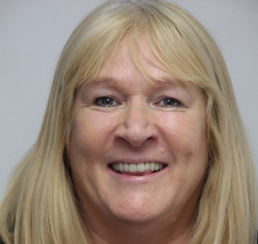 Smile Gallery - Church Road Dental and Cosmetic