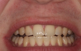Smile Gallery - Church Road Dental and Cosmetic
