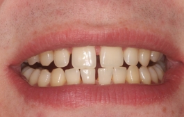 Smile Gallery - Church Road Dental and Cosmetic