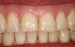 Smile Gallery - Church Road Dental and Cosmetic