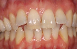 Smile Gallery - Church Road Dental and Cosmetic