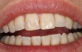 Smile Gallery - Church Road Dental and Cosmetic