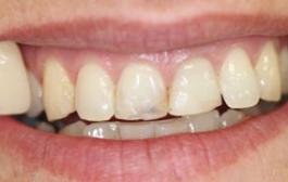 Smile Gallery - Church Road Dental and Cosmetic