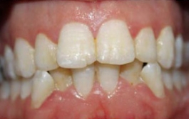 Smile Gallery - Church Road Dental and Cosmetic