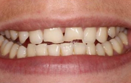 Smile Gallery - Church Road Dental and Cosmetic