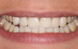Smile Gallery - Church Road Dental and Cosmetic