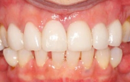 Smile Gallery - Church Road Dental and Cosmetic