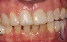 Smile Gallery - Church Road Dental and Cosmetic