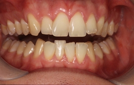 Smile Gallery - Church Road Dental and Cosmetic