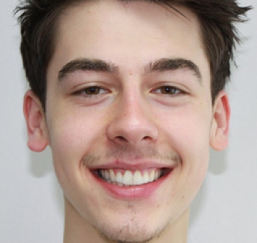 Smile Gallery - Church Road Dental and Cosmetic
