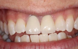 Smile Gallery - Church Road Dental and Cosmetic