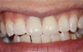 Smile Gallery - Church Road Dental and Cosmetic