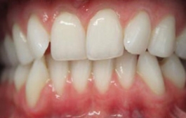 Smile Gallery - Church Road Dental and Cosmetic