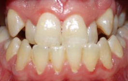 Smile Gallery - Church Road Dental and Cosmetic