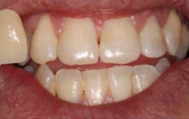 Smile Gallery - Church Road Dental and Cosmetic