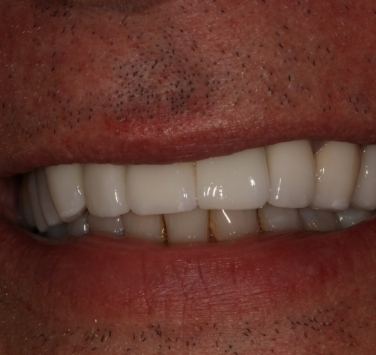 Smile Gallery - Church Road Dental and Cosmetic