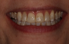 Smile Gallery - Church Road Dental and Cosmetic