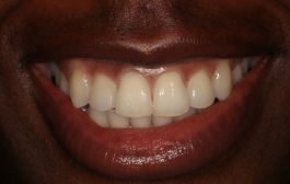Smile Gallery - Church Road Dental and Cosmetic