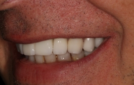 Smile Gallery - Church Road Dental and Cosmetic