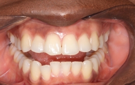 Smile Gallery - Church Road Dental and Cosmetic