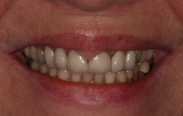 Smile Gallery - Church Road Dental and Cosmetic