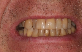 Smile Gallery - Church Road Dental and Cosmetic