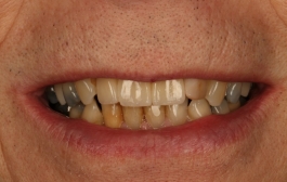 Smile Gallery - Church Road Dental and Cosmetic