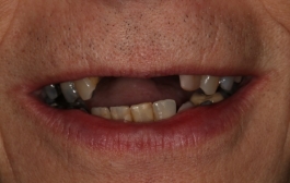 Smile Gallery - Church Road Dental and Cosmetic