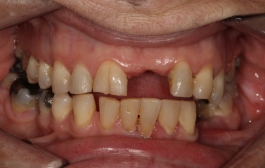 Smile Gallery - Church Road Dental and Cosmetic