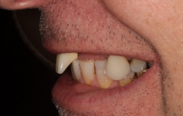 Smile Gallery - Church Road Dental and Cosmetic