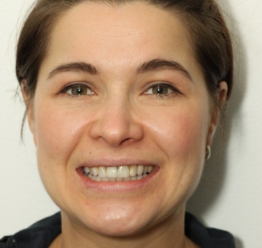 Smile Gallery - Church Road Dental and Cosmetic