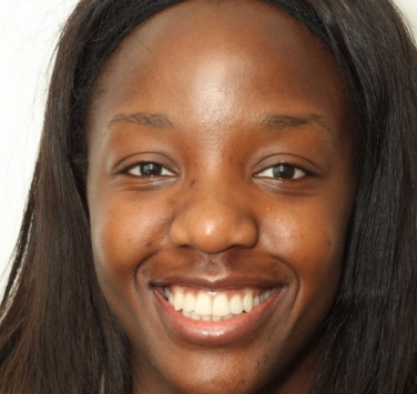 Smile Gallery - Church Road Dental and Cosmetic