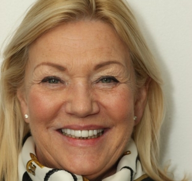 Smile Gallery - Church Road Dental and Cosmetic