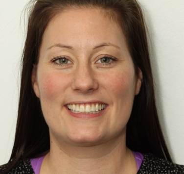 Smile Gallery - Church Road Dental and Cosmetic
