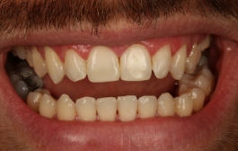 Smile Gallery - Church Road Dental and Cosmetic