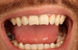 Smile Gallery - Church Road Dental and Cosmetic