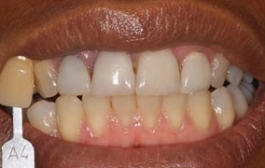 Smile Gallery - Church Road Dental and Cosmetic