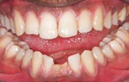 Smile Gallery - Church Road Dental and Cosmetic