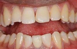 Smile Gallery - Church Road Dental and Cosmetic