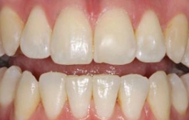 Smile Gallery - Church Road Dental and Cosmetic