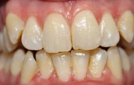 Smile Gallery - Church Road Dental and Cosmetic
