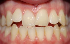 Smile Gallery - Church Road Dental and Cosmetic