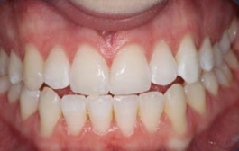 Smile Gallery - Church Road Dental and Cosmetic