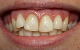 Smile Gallery - Church Road Dental and Cosmetic